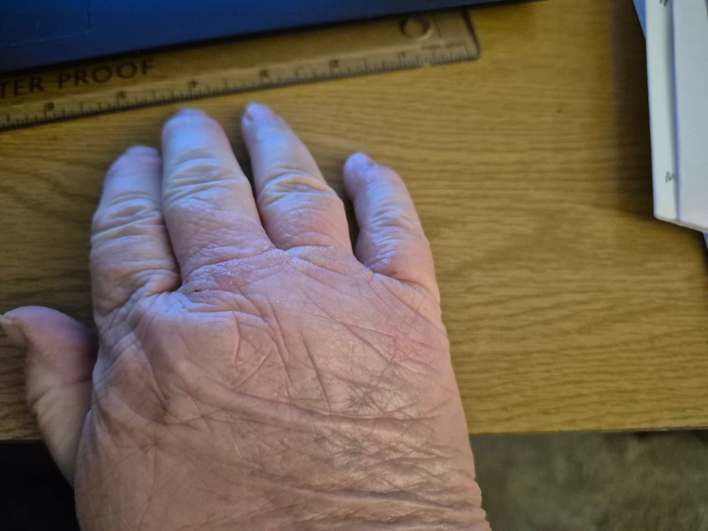 Customer photo review of Large Bioskin Duo Pack