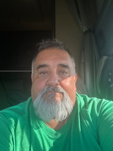 Customer photo review of TryTallow™ Grass-Fed Tallow Face Balm (4oz)