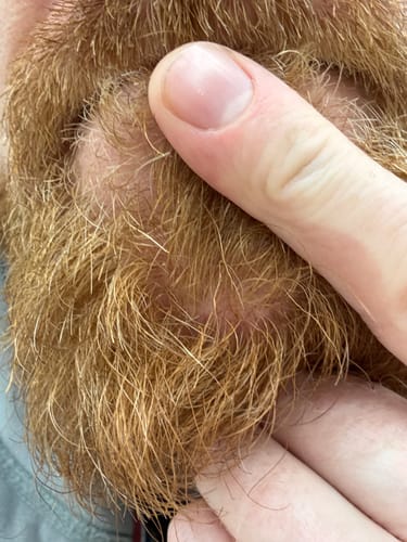 Customer photo review of Seb Natural Calming Serum