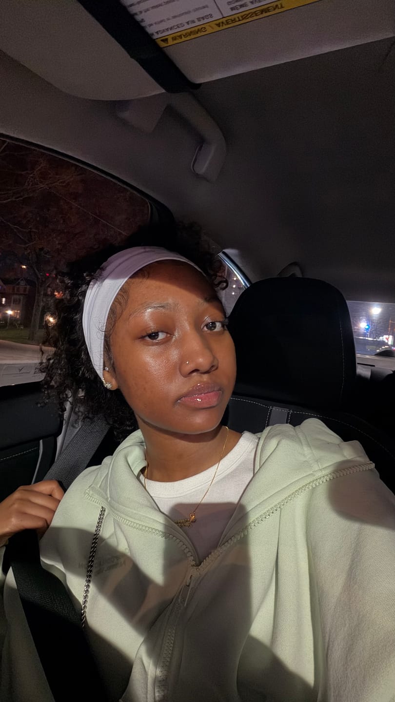 Customer photo review of Duo Skincare Bundle