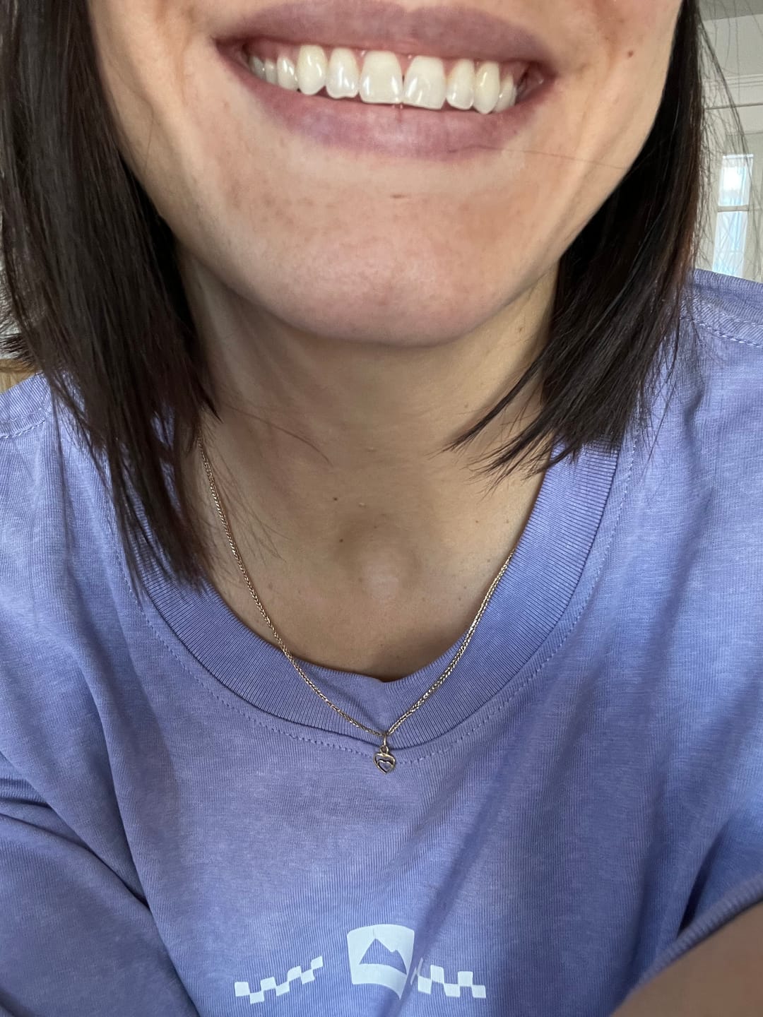 Customer photo review of Bandes Violettes Kauka Smile (sans peroxyde)