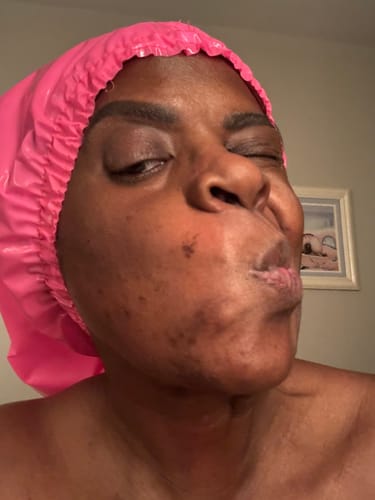 Customer photo review of Melanin Skin Bundle (40% off)