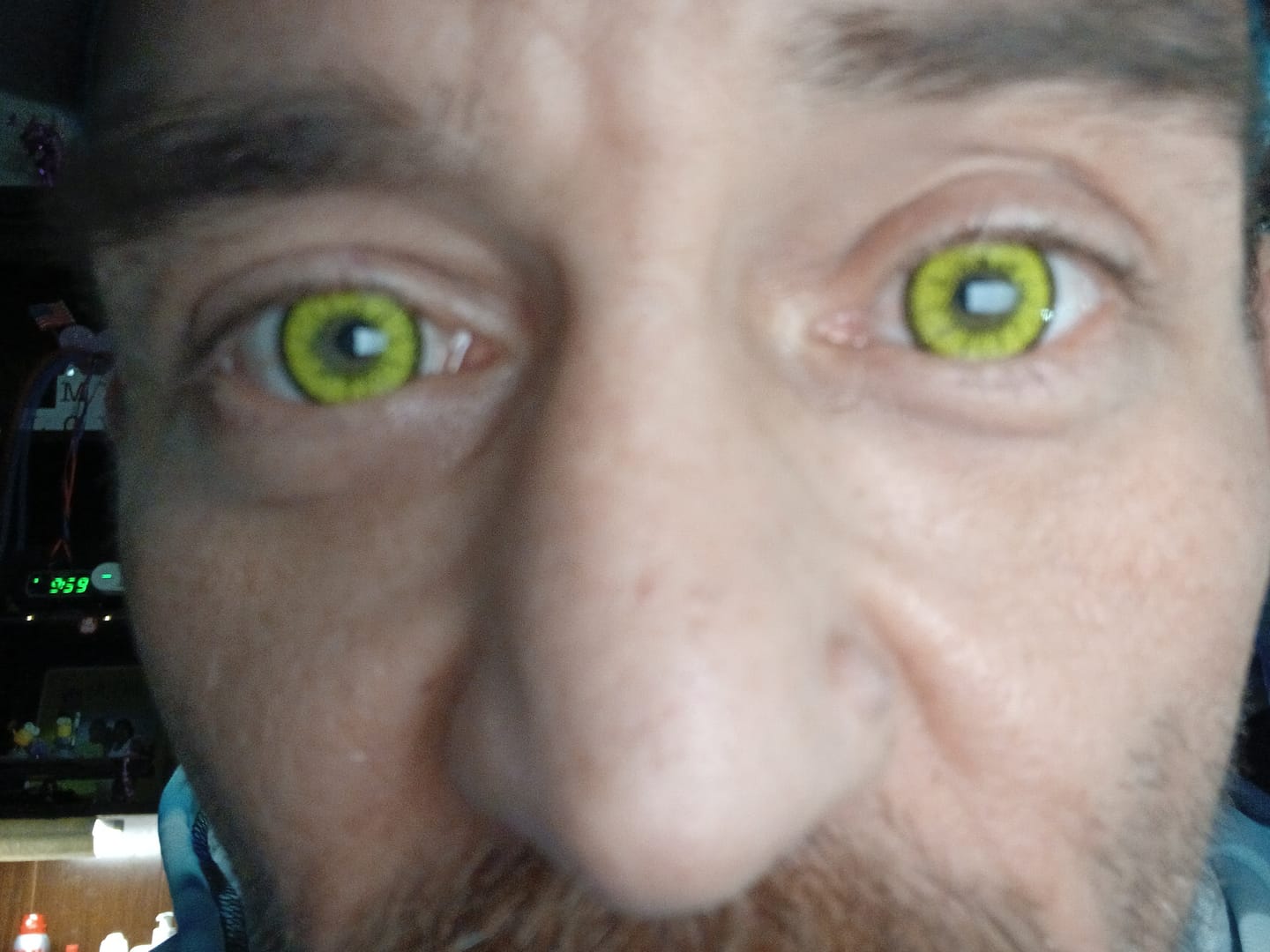 Customer photo review of Cosplay ICE Yellow Prescription Colored Contact Lenses