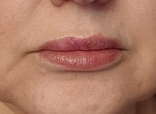 Customer photo review of SUPREME LIPS POWIĘKSZACZ DO UST