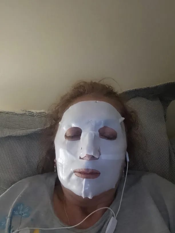 Customer photo review of Bio-Collagen Face Mask