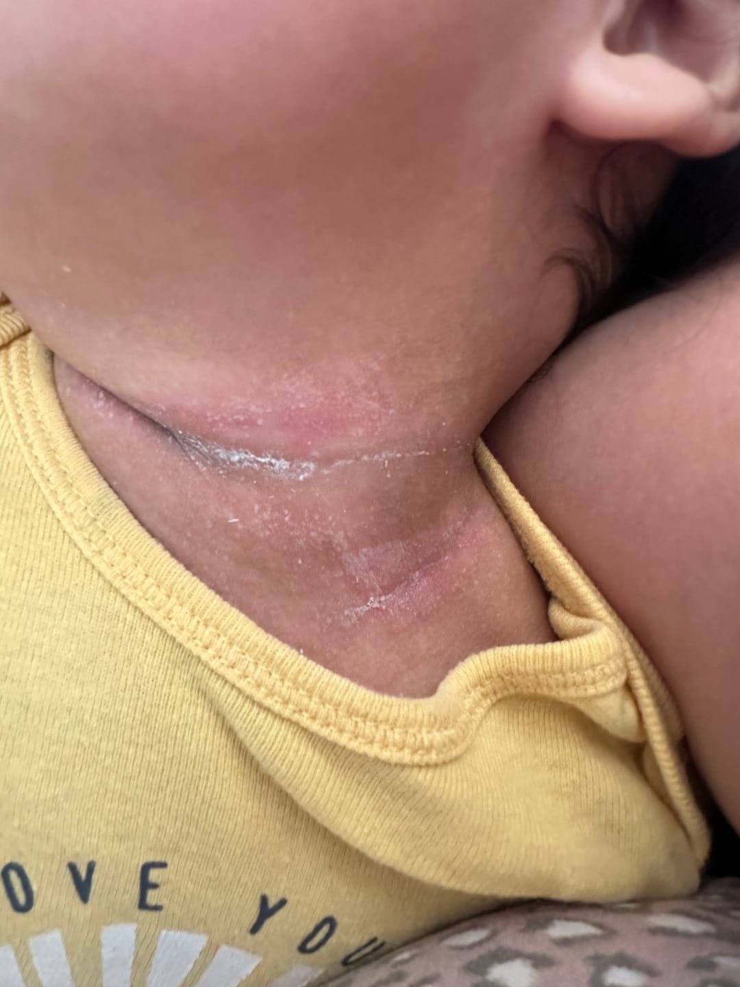 Customer photo review of BUY 2, GET 1 FREE