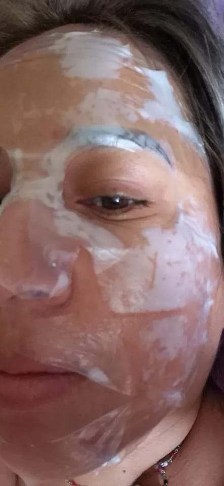 Customer photo review of Bio-Collagen Face Mask
