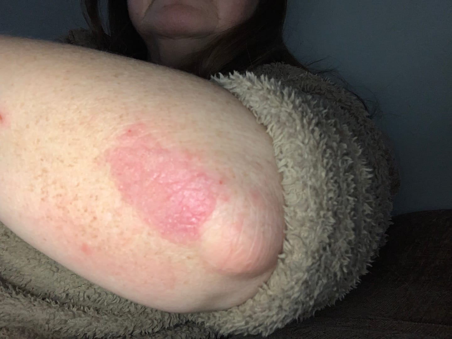 Customer photo review of Head to Toe Bundle | Body & Face Tallow