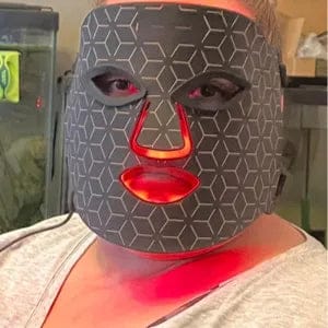 Customer photo review of 240-Light Infrared LED Mask for Face and Neck Advanced Skin Care