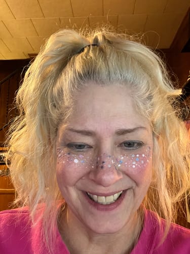 Customer photo review of Snowflake Speckles - Limited Edition