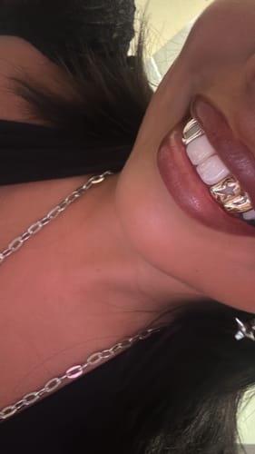 Customer photo review of ORION (GOLD GRILLZ)