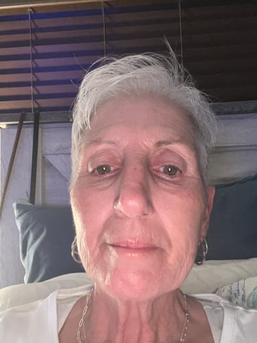 Customer photo review of Glov Micro Infusion System