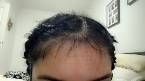 Customer photo review of Hair Growth Oil