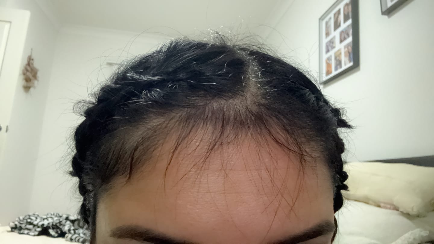 Customer photo review of Hair Growth Oil