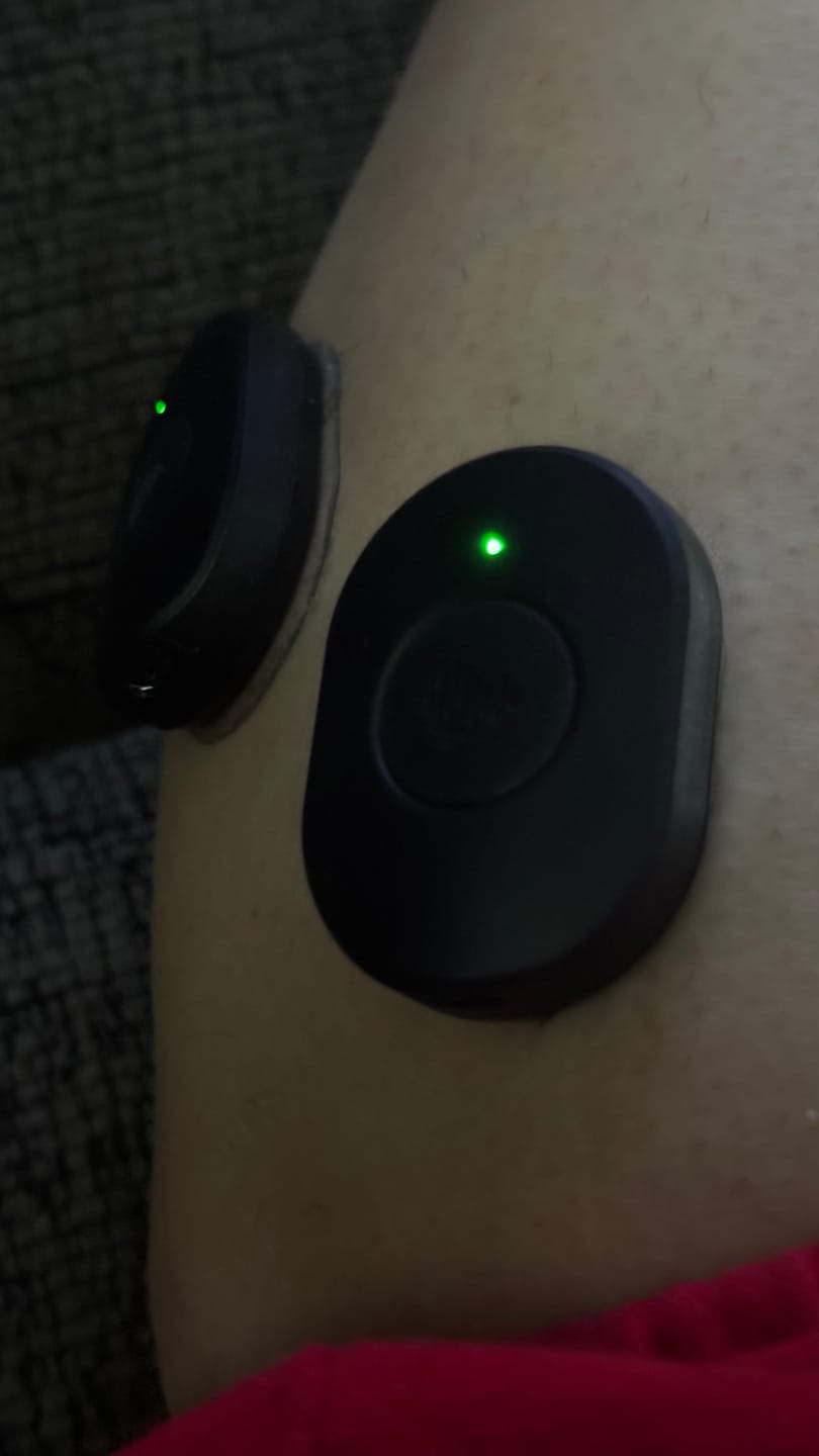 Customer photo review of Pulse Device Bundle