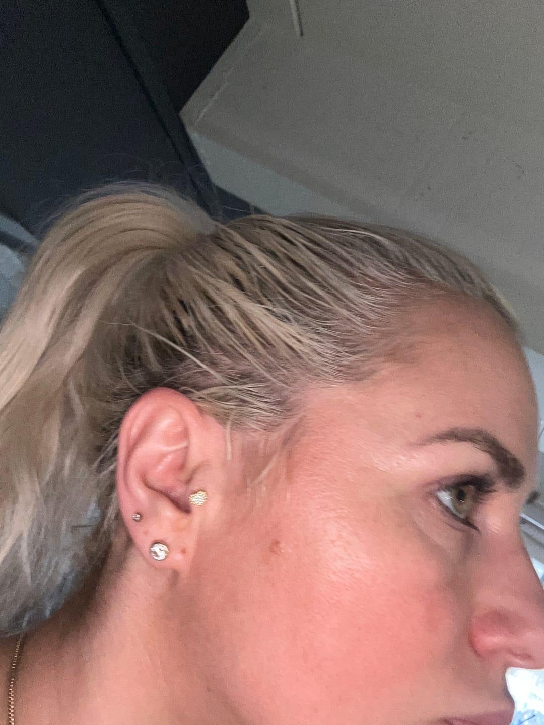 Customer photo review of 10er Pack GLOWYSIDEUP® Overnight Leave-On Maske