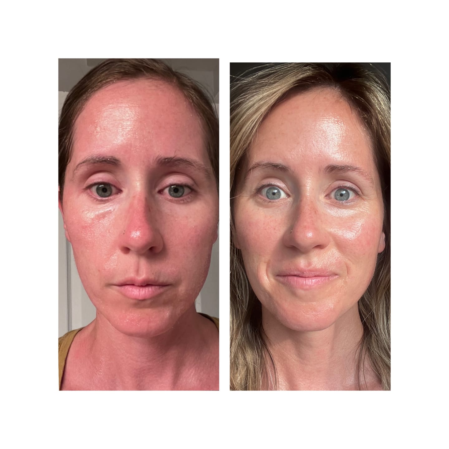 Customer photo review of GLOW RED LIGHT WAND