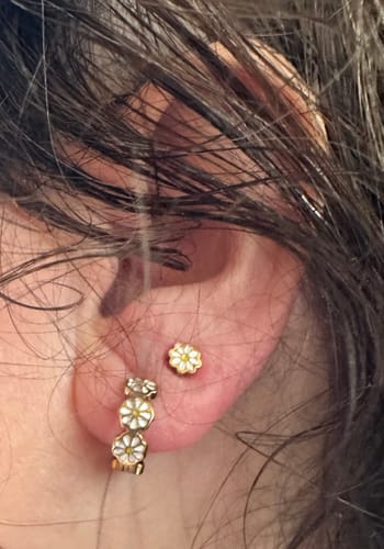 Customer photo review of Daisy Huggies