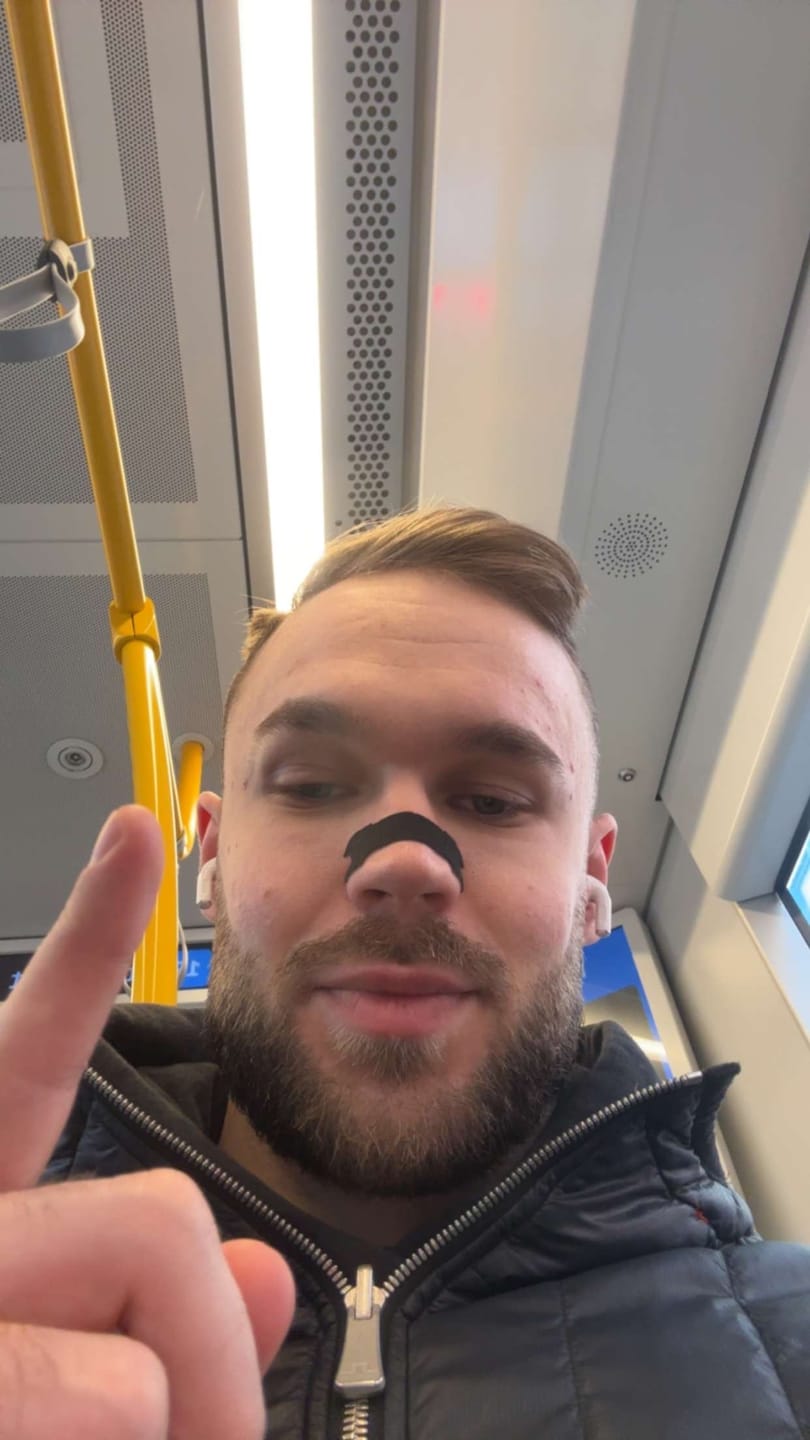 Customer photo review of NASAL STRIPS | BLACK