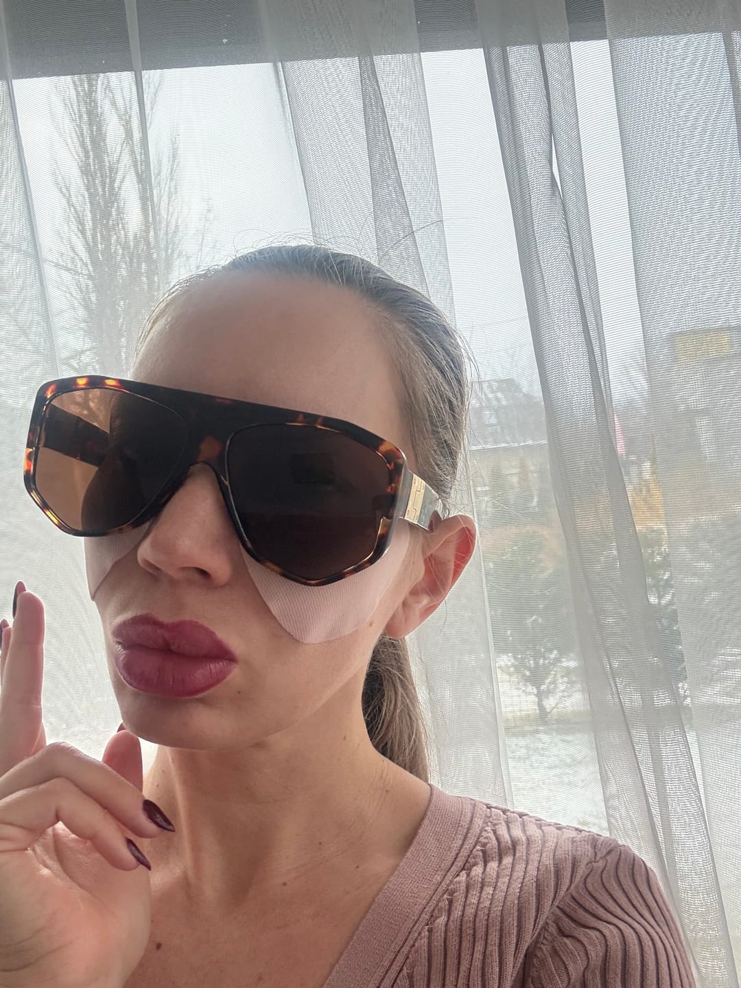 Customer photo review of Дълбоко хидратиращи лифтинг пачове с Азиатика Центела, Хиалуронова киселина и Ниацинамид Chamos Mattang