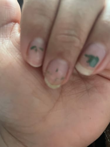 Customer photo review of Cosmic Collagen Beauty Complex - 64,000MCG - Illuminate Your Radiance!