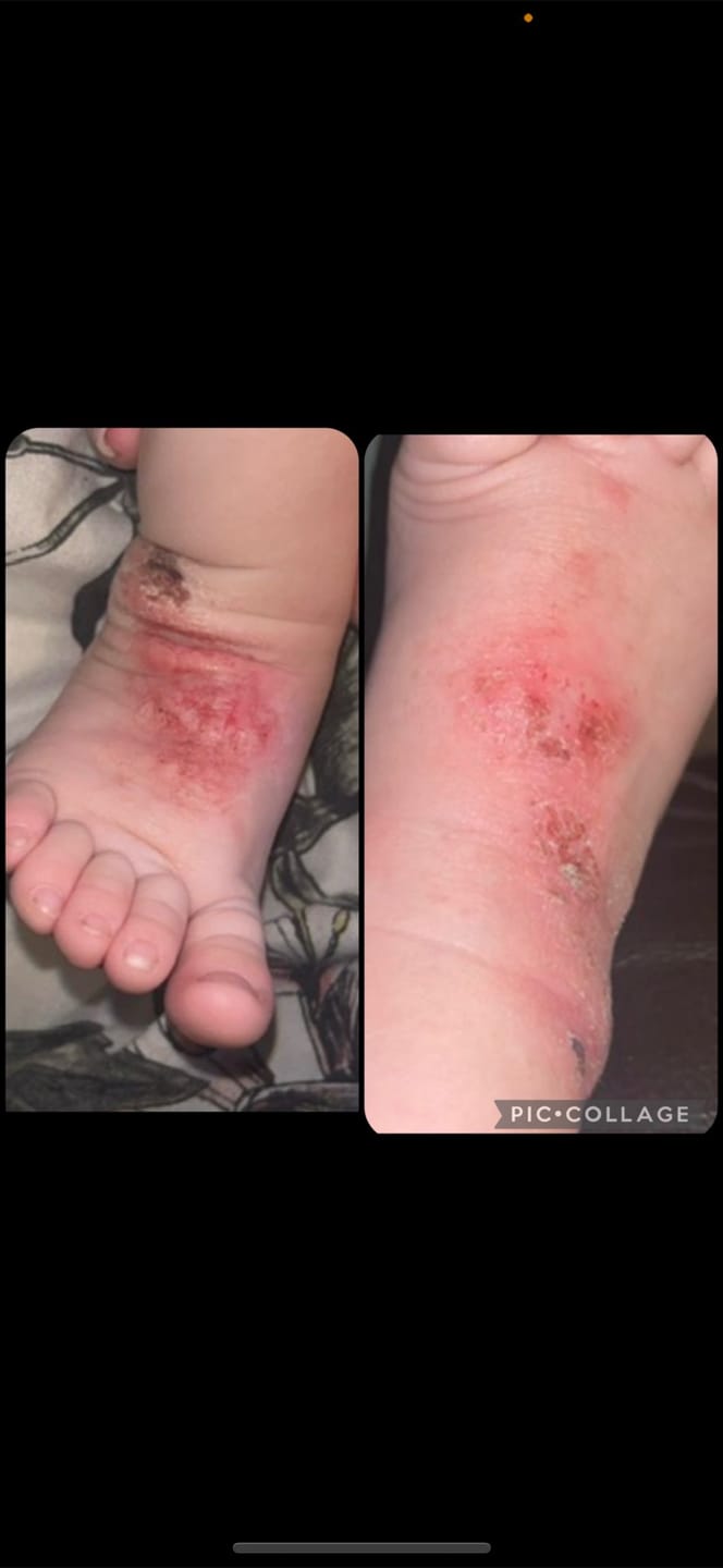 Customer photo review of Bioskin Junior Daily Nourishing Spray