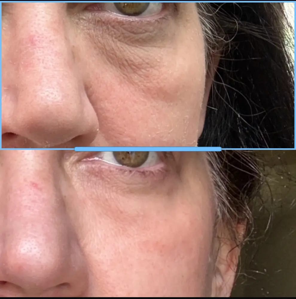 Customer photo review of Under Eye Skincare Wand
