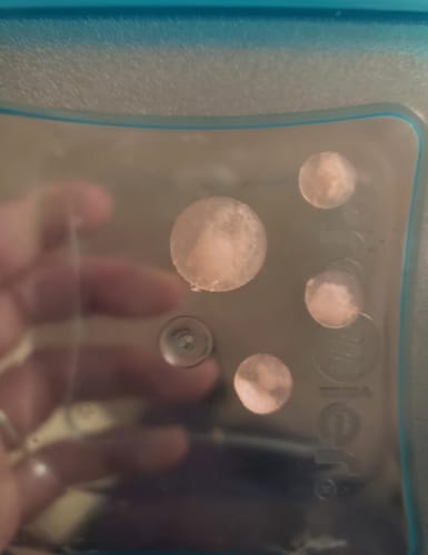 Customer photo review of Acne Patches