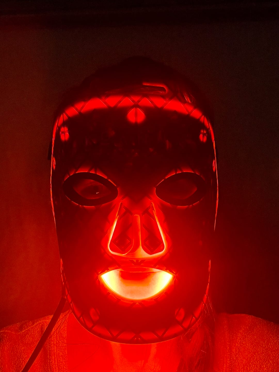 Customer photo review of Koanna® MultiGlo™ LED Light Therapy Mask