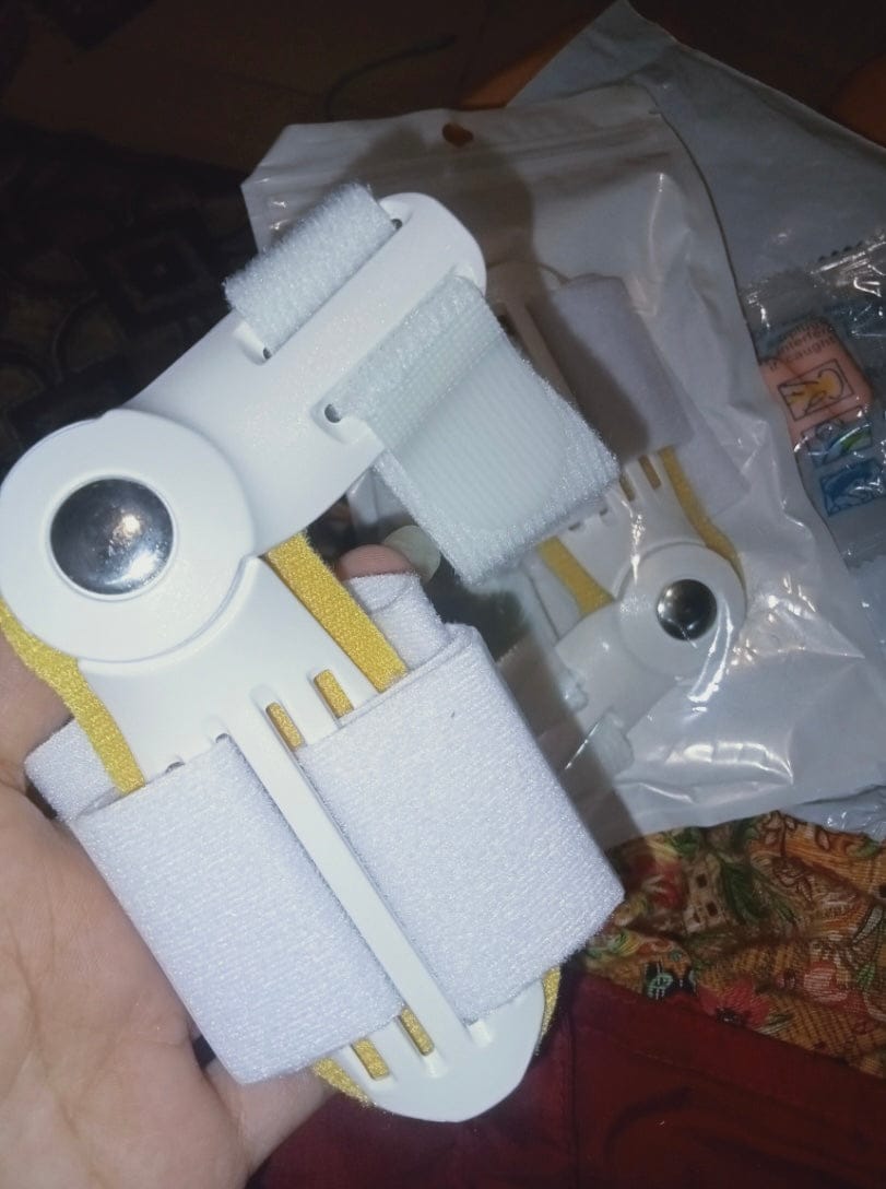 Customer photo review of Pain Relief Bunion Toe Corrector - (IMPORTED)
