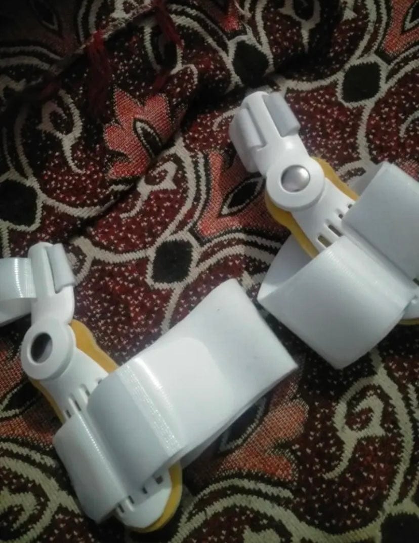 Customer photo review of Pain Relief Bunion Toe Corrector - (IMPORTED)