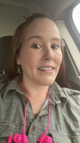 Customer photo review of Imako® Cosmetic Teeth Kit