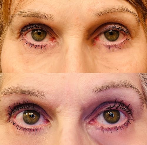 Customer photo review of SHOW LASH