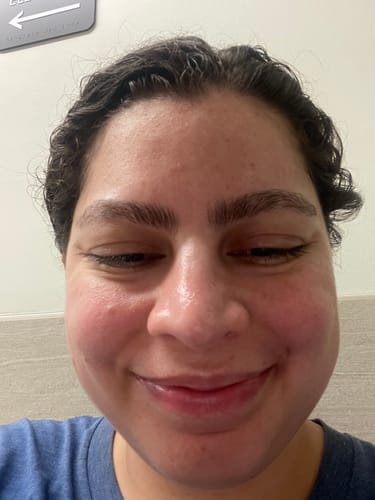 Customer photo review of Balancing moisturizer