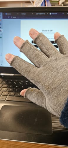 Customer photo review of Premium Onecompress™ Gloves