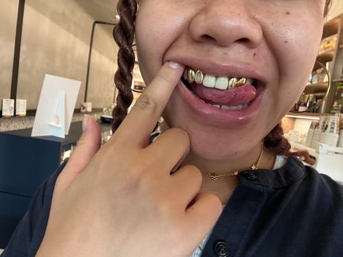 Customer photo review of NOVA (GOLD PLATED GRILLZ)