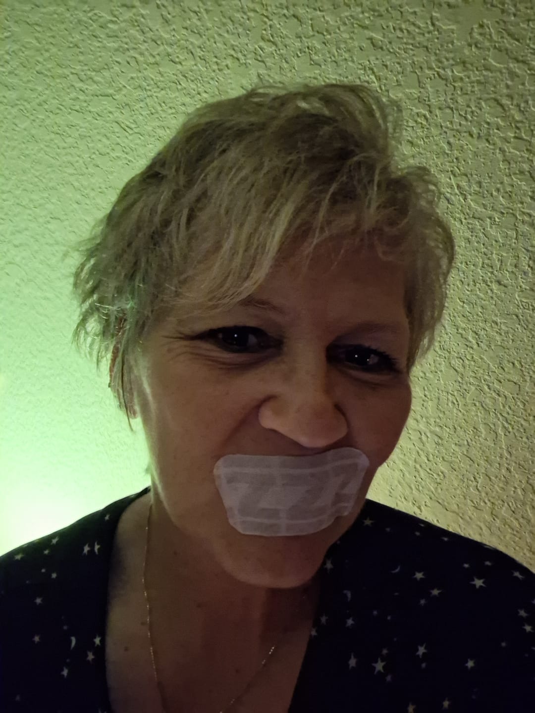 Customer photo review of ZzzTape - Mouth Tape