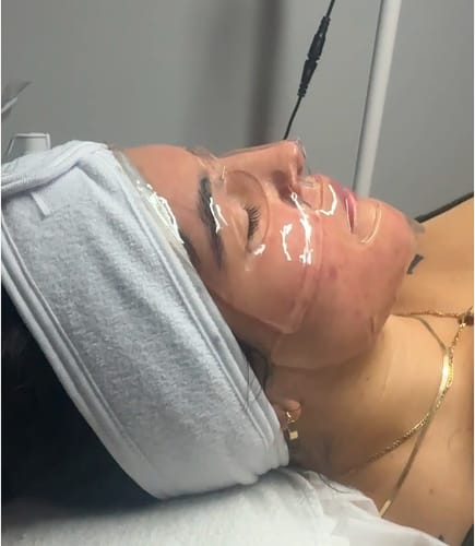 Customer photo review of The CryoPeptide 20 Pack