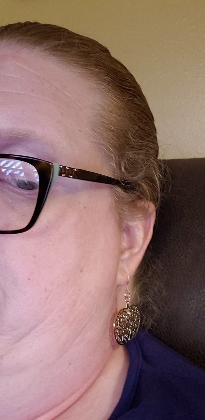 Customer photo review of Veiny Pumpkin Dangles Hypoallergenic Earrings for Sensitive Ears Made with Plastic Hooks