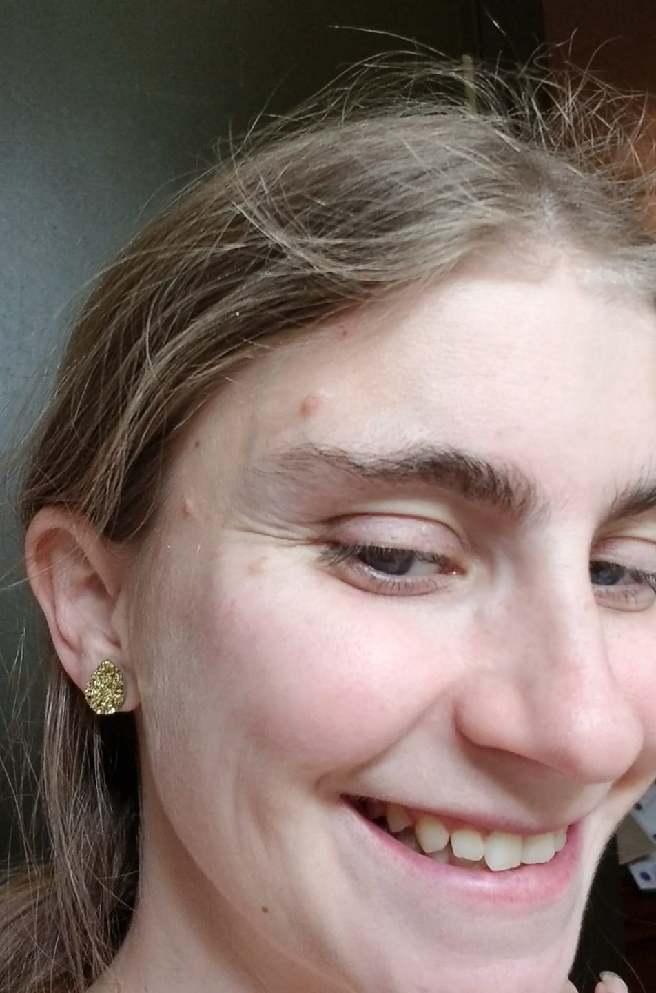 Customer photo review of Teardrop Faux Druzy Studs Hypoallergenic Earrings for Sensitive Ears Made with Plastic Posts