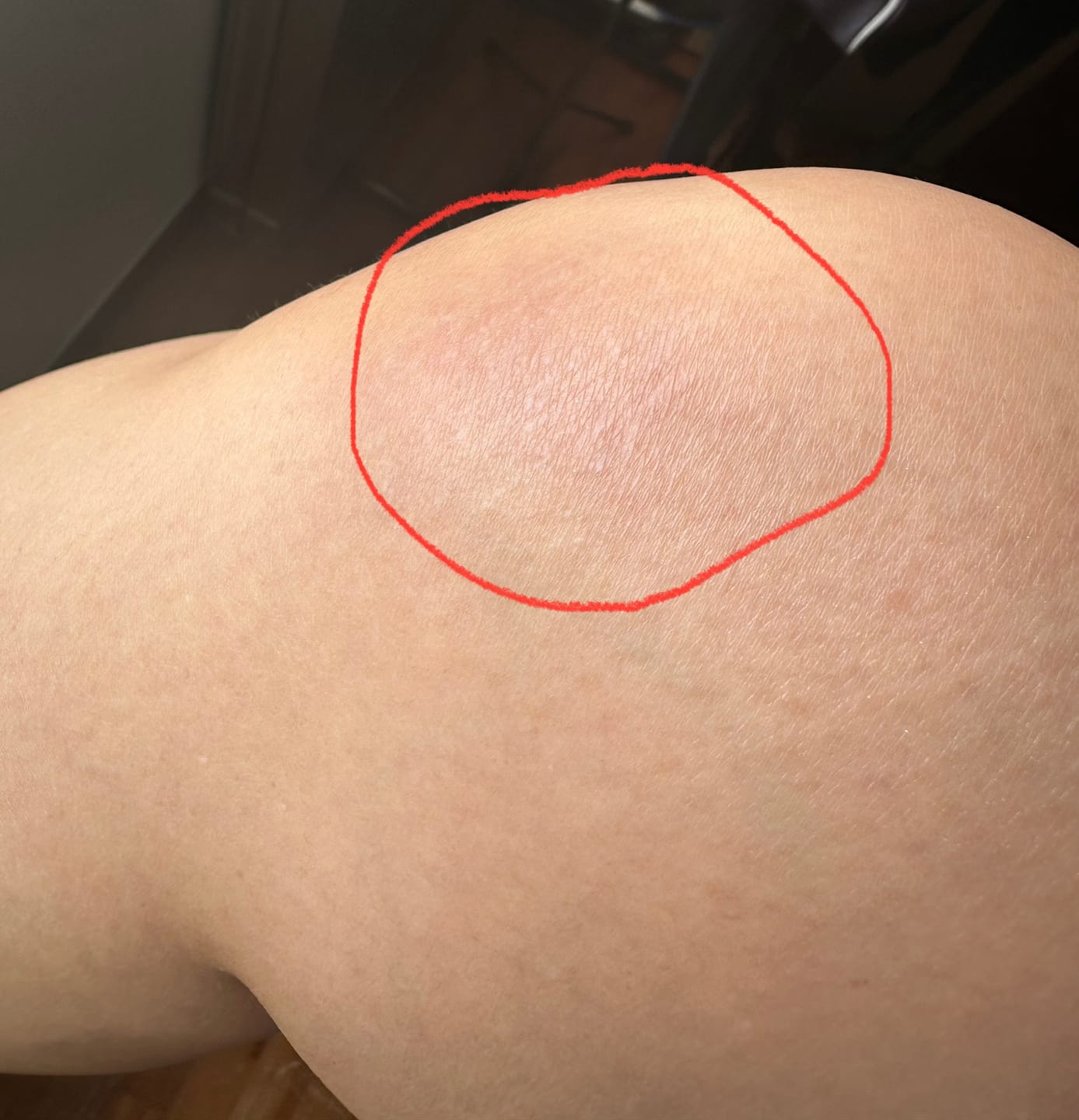 Customer photo review of Freedom by KlaritySGᵀᴹ - Medical Grade Bioactive Collagen Peptides to heal Joint pain
