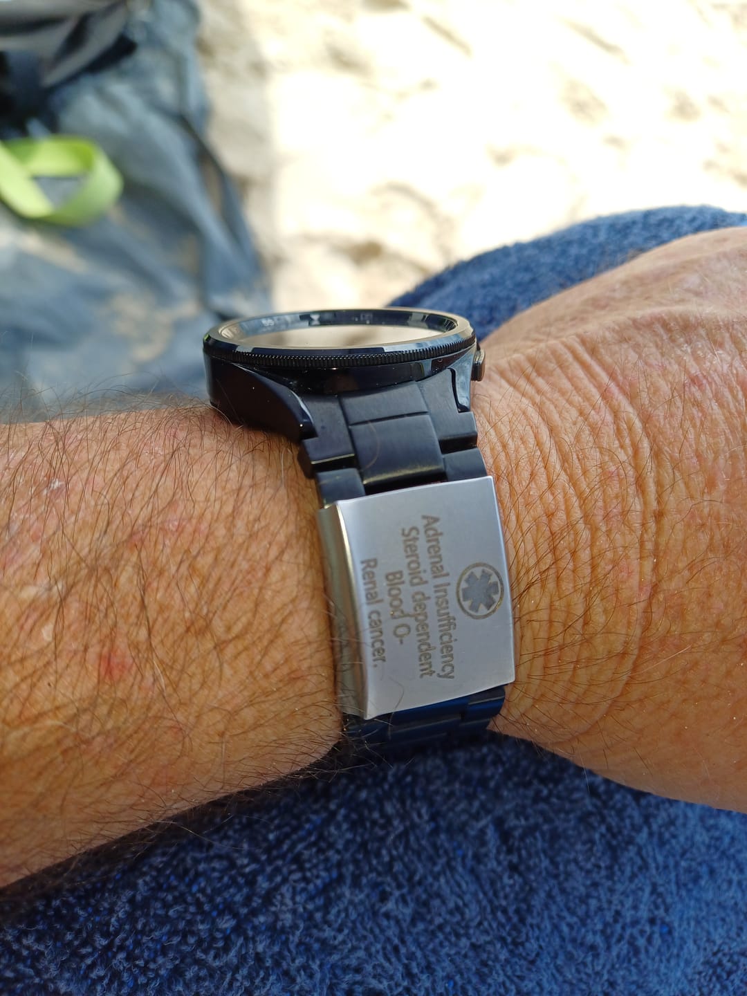 Customer photo review of Personalised ID Tag for Watch Band & Fitness Trackers