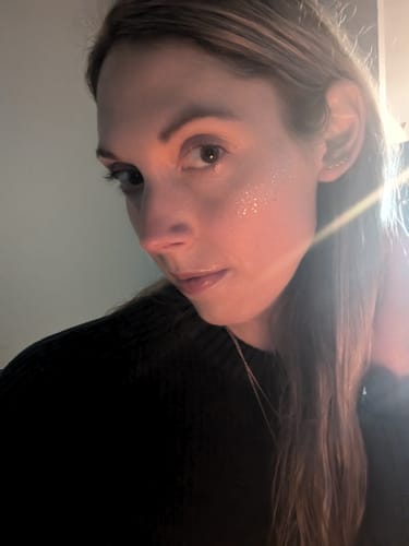 Customer photo review of Gold Glitter Freckles Makeup Patches