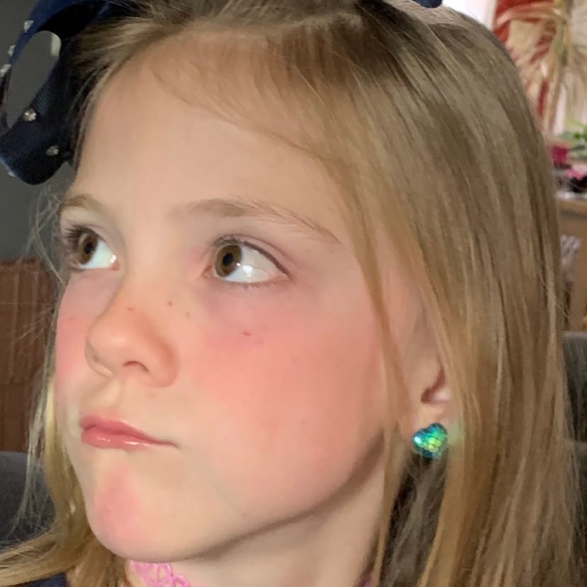 Customer photo review of Heart Mermaid Studs Hypoallergenic Earrings for Sensitive Ears Made with Plastic Posts
