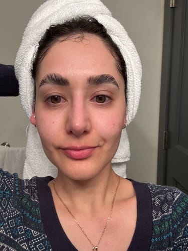 Customer photo review of Formula Personalizada (Rx)