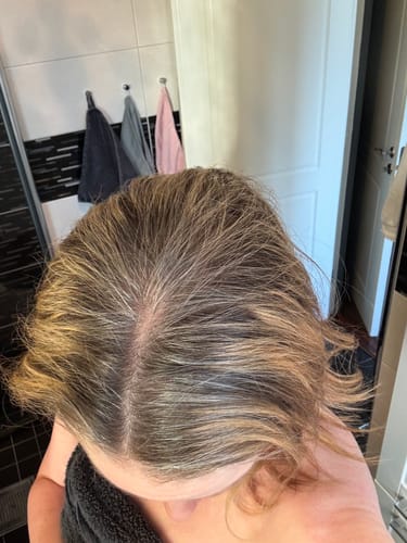 Customer photo review of Sunkissed Starter Kit