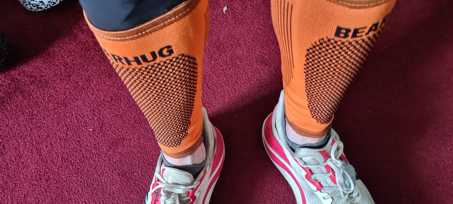 Customer photo review of Pair of Calf Compression Support Sleeves For Shin Splint Pain Relief