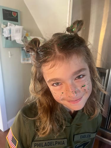 Customer photo review of Green Spirit Speckles Makeup Patches - Team Spirit Collection SHIPS 1/30