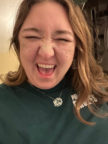 Customer photo review of Green Spirit Speckles Makeup Patches - Team Spirit Collection SHIPS 1/30