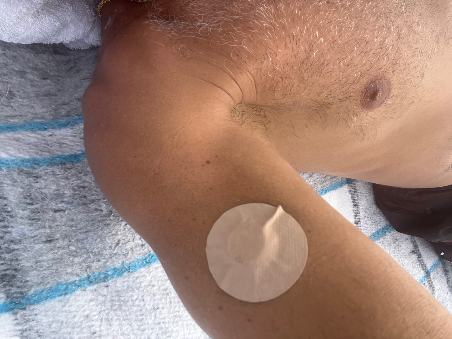 Customer photo review of Skin Grip MAX Freestyle Libre 3 Patches - 10 Pack